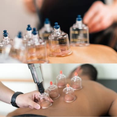 hijama-and-cupping-therapy