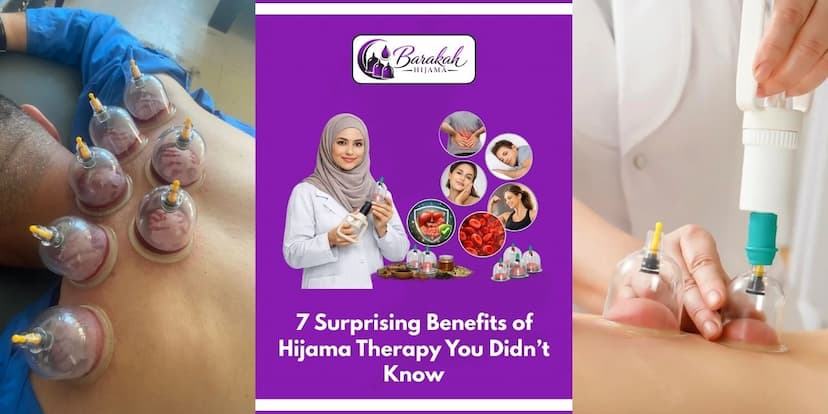 https://api.barakahhijama.com/aritcles/7-surprising-benefits-of-hijama-therapy-you-didn’t-know.jpg
