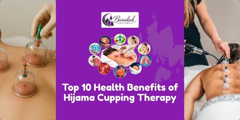 https://api.barakahhijama.com/aritcles/Top-10-health-benefits-of-hijama-cupping-therapy-.jpg