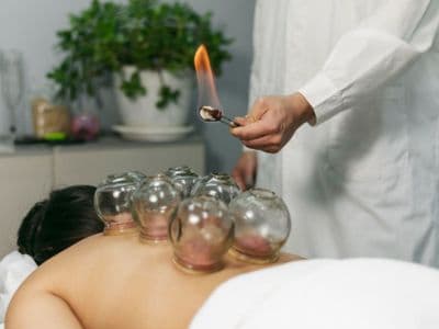 Hijama with Cupping