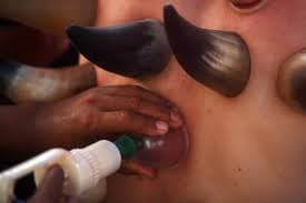 Hijama with Horns