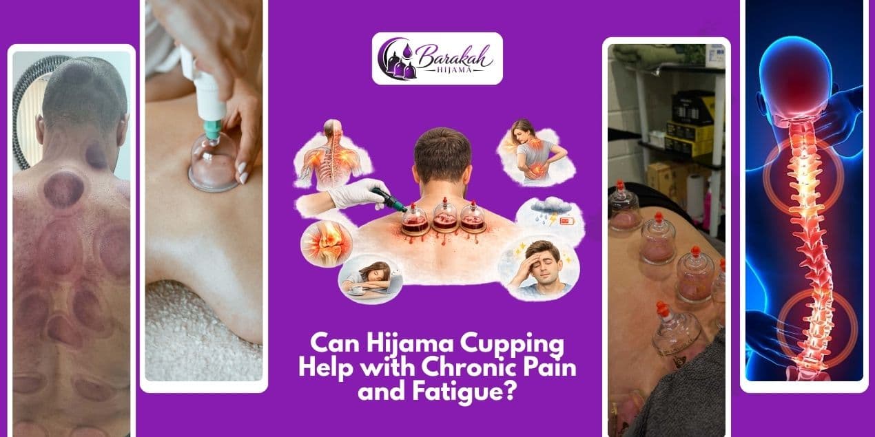 aritcles/Can-hijama-cupping-help-with-chronic-pain-and-fatigue.jpg.jpeg aritcles/Can-hijama-cupping-help-with-chronic-pain-and-fatigue.jpg.jpeg