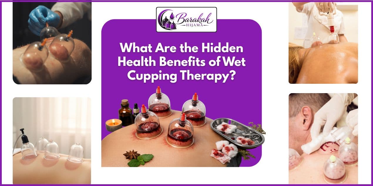 aritcles/what-are-the-hidden-health-benefits-of-wet-cupping-therapy.jpg.jpeg aritcles/what-are-the-hidden-health-benefits-of-wet-cupping-therapy.jpg.jpeg